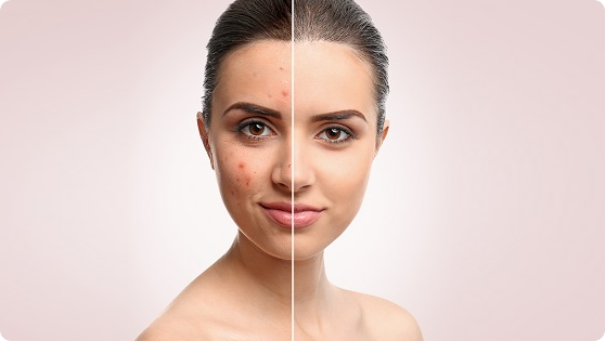 Dermatology Treatments