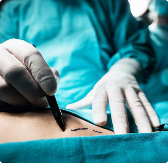 List of Plastic Surgery Conditions